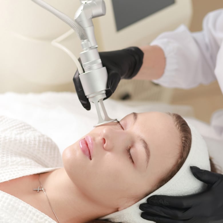 laser cicatrices et taches